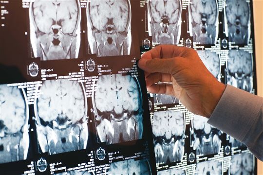Röntgenbild vom Kopf